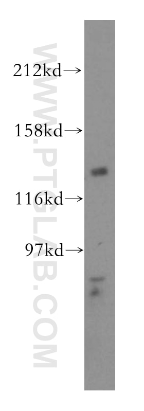 Western Blot (WB) analysis of HepG2 cells using POLR3B Polyclonal antibody (16574-1-AP)