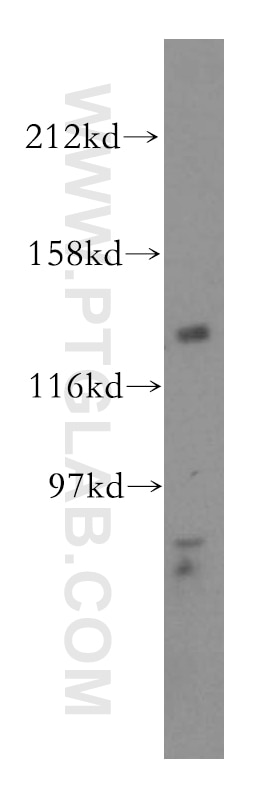 WB analysis of HepG2 using 16574-1-AP