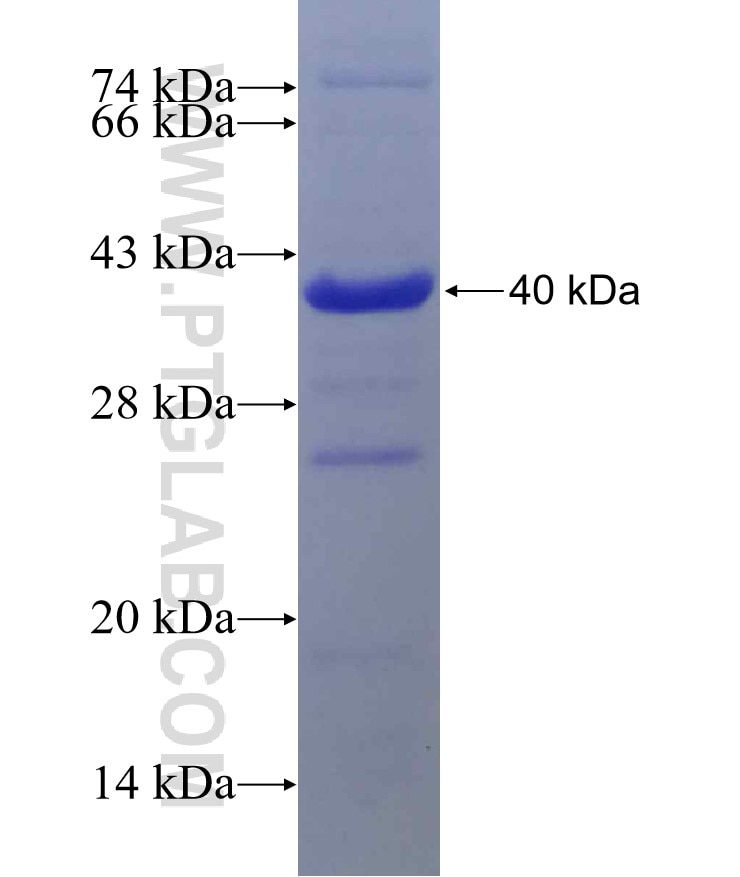 POLR3B fusion protein Ag10076 SDS-PAGE
