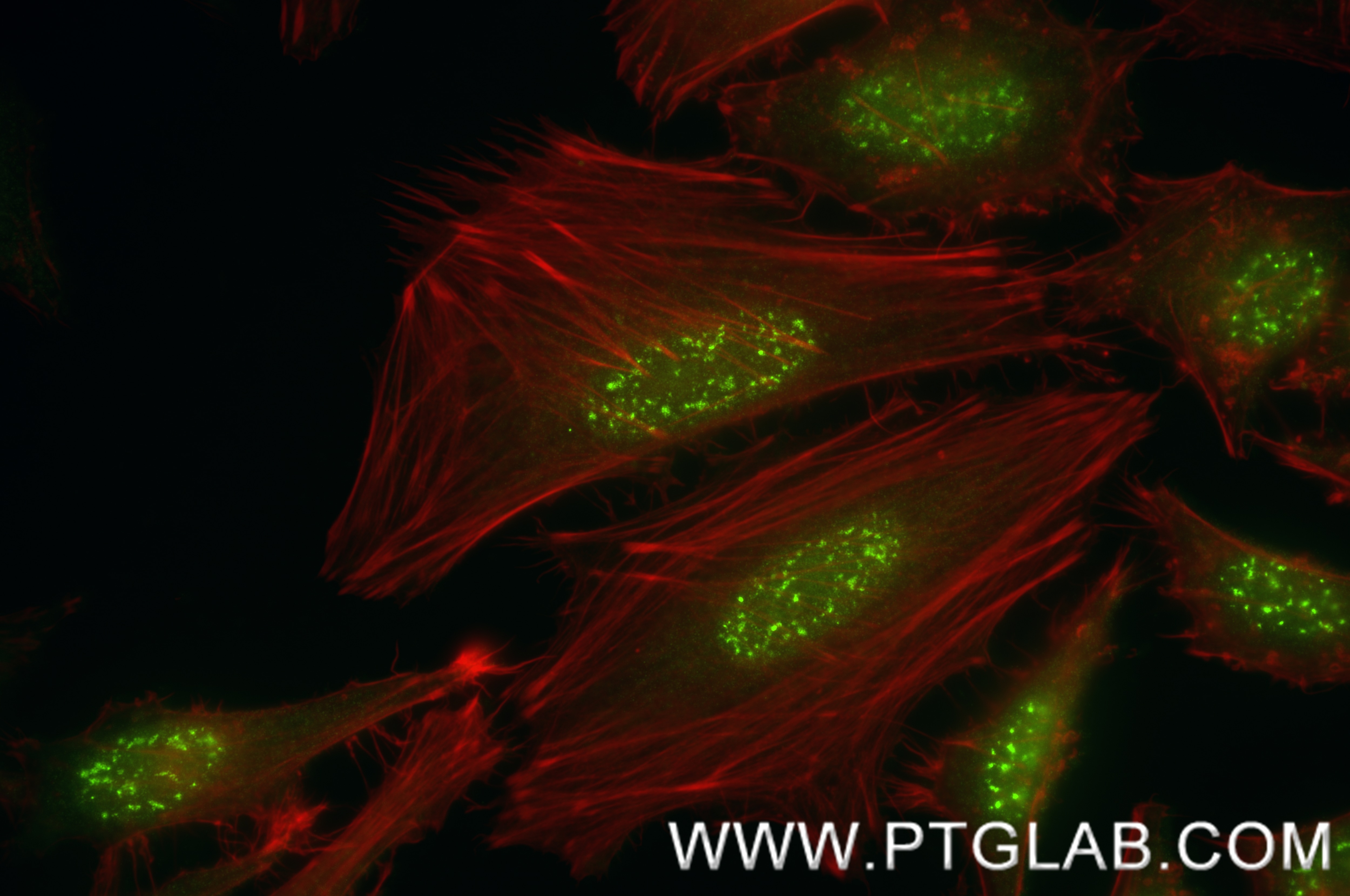 Immunofluorescence (IF) / fluorescent staining of HeLa cells using POLR3C Recombinant antibody (84367-6-RR)