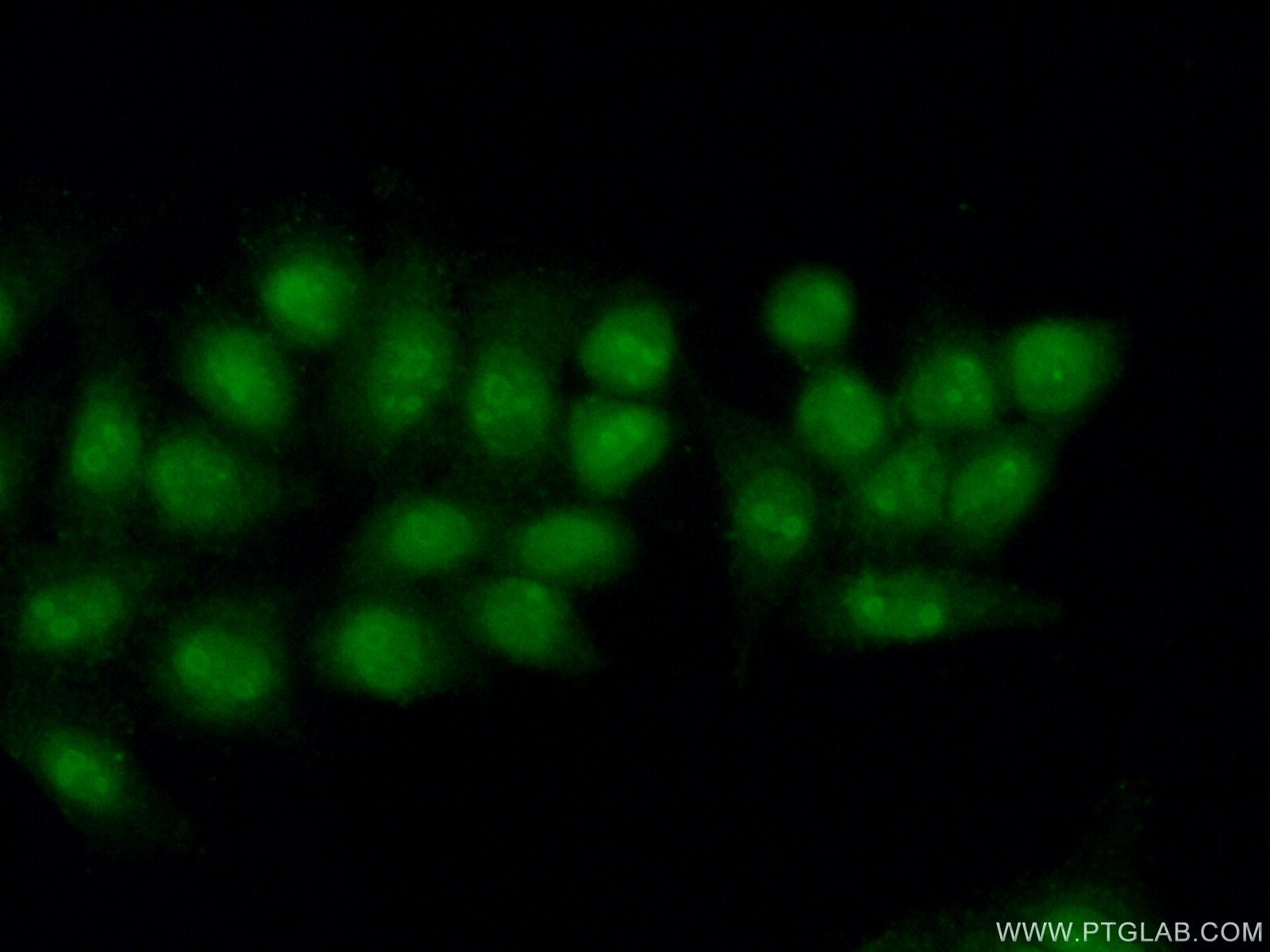 Immunofluorescence (IF) / fluorescent staining of HeLa cells using POLR3D Polyclonal antibody (15339-1-AP)