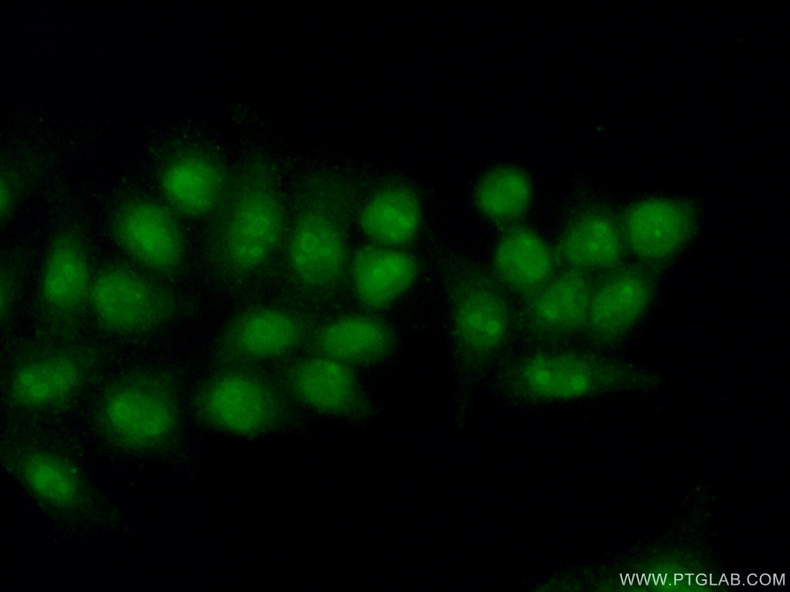 IF Staining of HeLa using 15339-1-AP