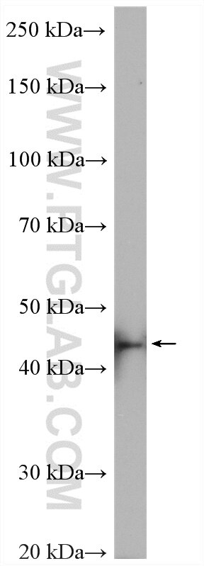 WB analysis of mouse testis using 15339-1-AP