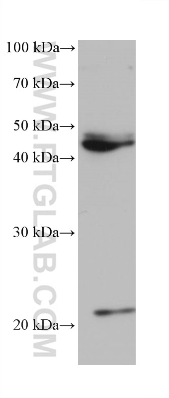 Western Blot (WB) analysis of rabbit brain tissue using POLR3D Monoclonal antibody (68263-1-Ig)