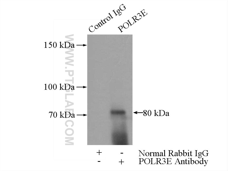 IP experiment of PC-3 using 15022-1-AP