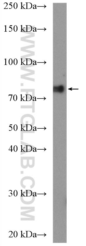 WB analysis of PC-3 using 15022-1-AP