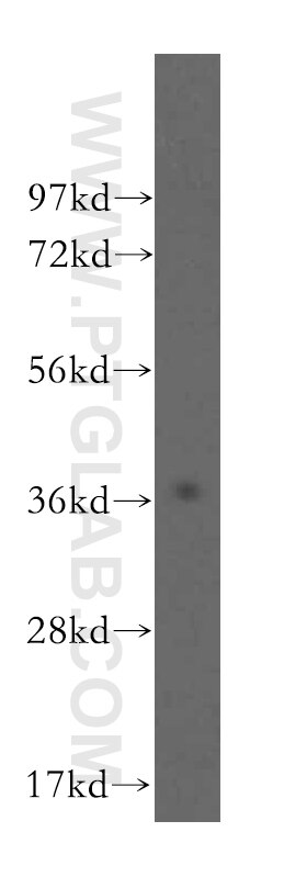 WB analysis of BxPC-3 using 16044-1-AP