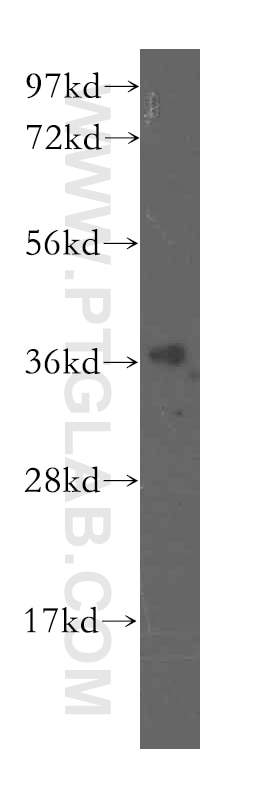 Western Blot (WB) analysis of human brain tissue using POLR3F Polyclonal antibody (16044-1-AP)