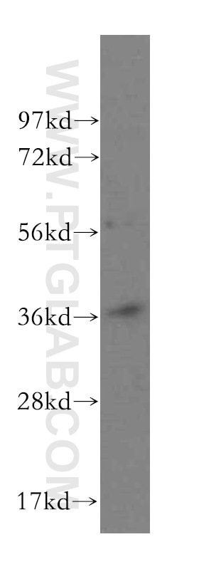 WB analysis of HeLa using 16044-1-AP