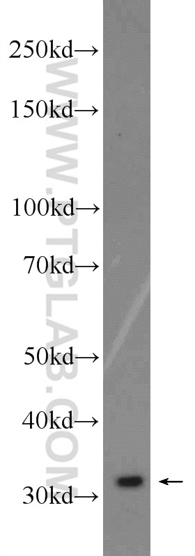 Western Blot (WB) analysis of HeLa cells using POLR3G Polyclonal antibody (24701-1-AP)