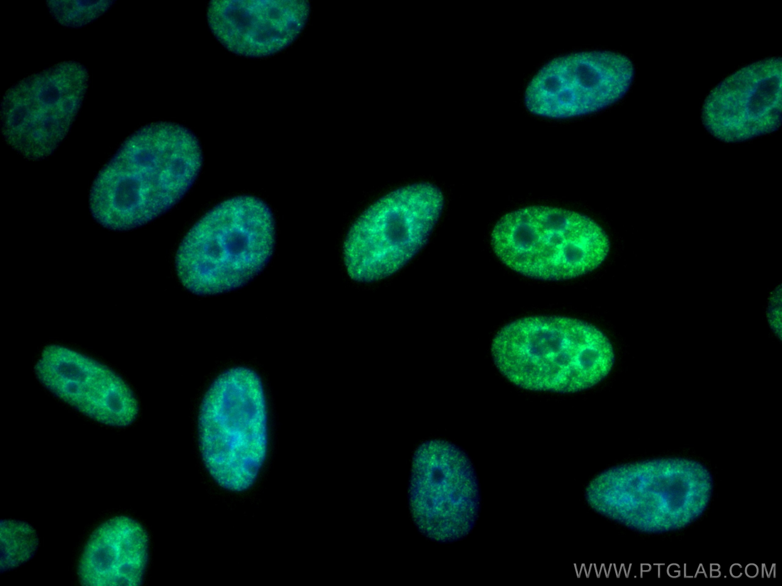 Immunofluorescence (IF) / fluorescent staining of HepG2 cells using POLR3K Polyclonal antibody (11084-1-AP)