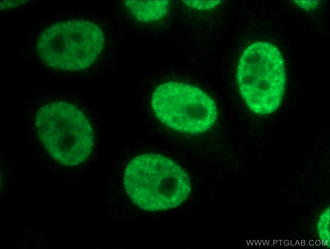 Immunofluorescence (IF) / fluorescent staining of HepG2 cells using POLR3K Polyclonal antibody (11084-1-AP)