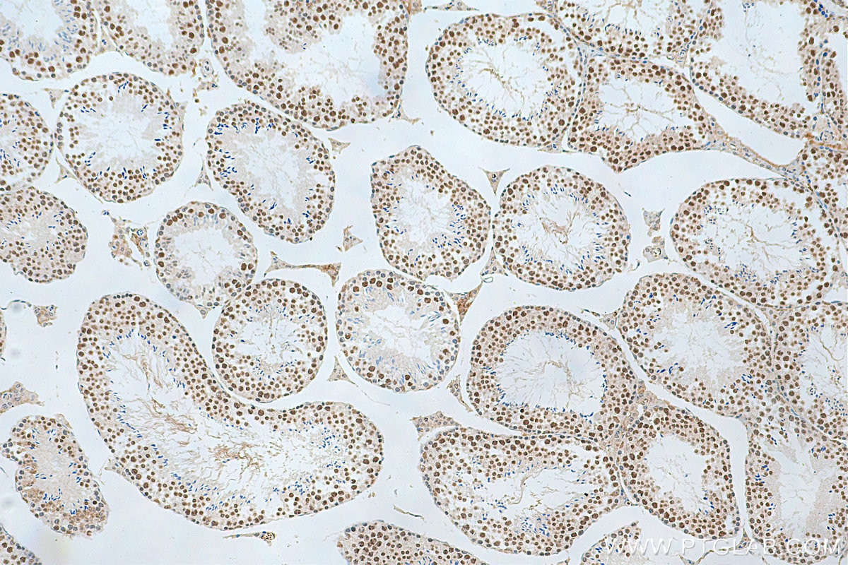 IHC staining of mouse testis using 11084-1-AP