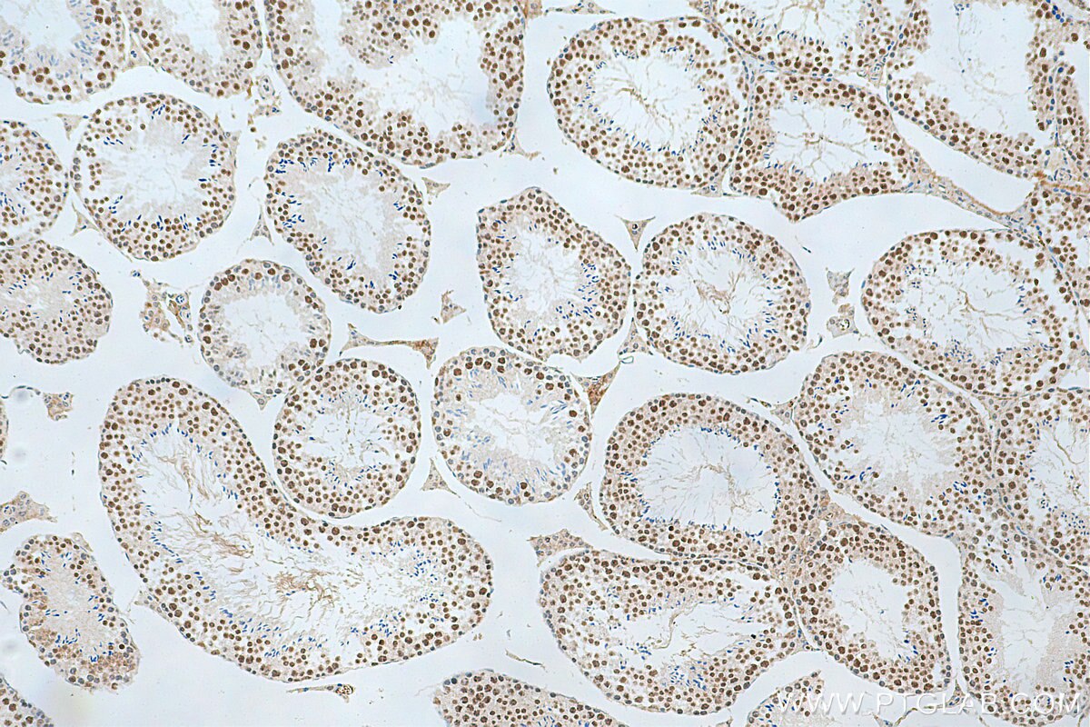 Immunohistochemistry (IHC) staining of mouse testis tissue using POLR3K Polyclonal antibody (11084-1-AP)