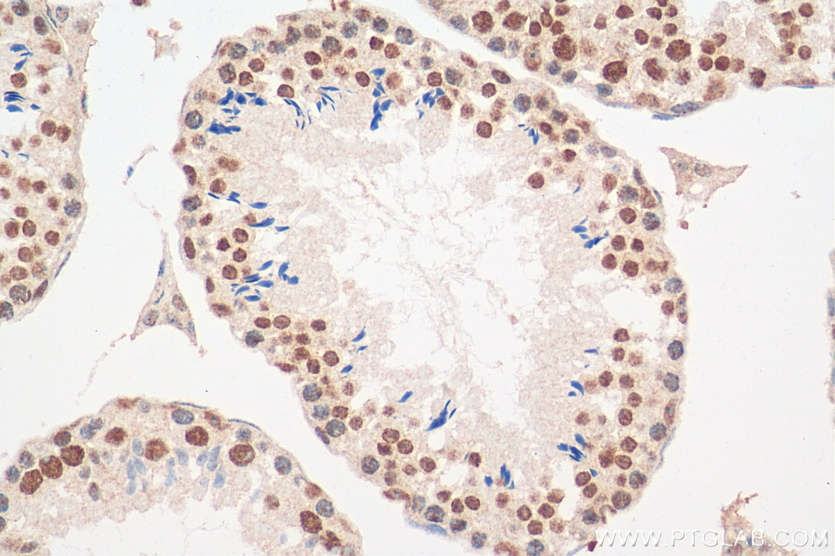 Immunohistochemistry (IHC) staining of mouse testis tissue using POLR3K Polyclonal antibody (11084-1-AP)
