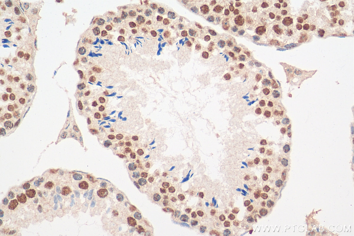 IHC staining of mouse testis using 11084-1-AP