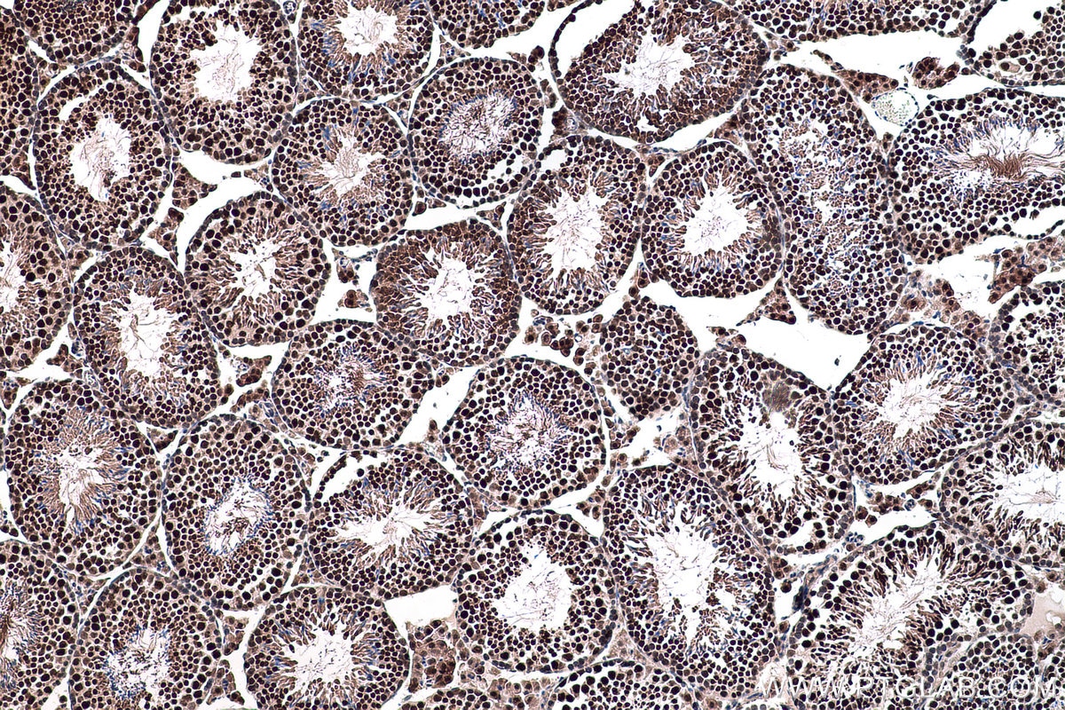 Immunohistochemistry (IHC) staining of mouse testis tissue using POLR3K Polyclonal antibody (11084-1-AP)