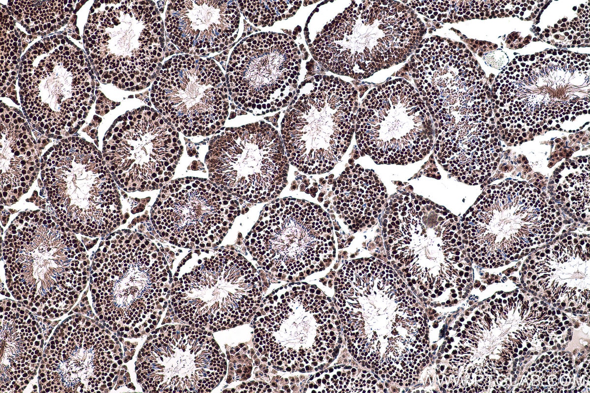 IHC staining of mouse testis using 11084-1-AP