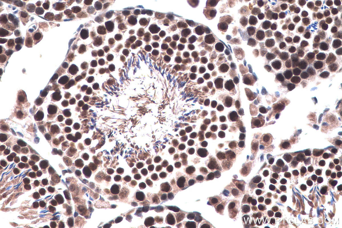 Immunohistochemistry (IHC) staining of mouse testis tissue using POLR3K Polyclonal antibody (11084-1-AP)