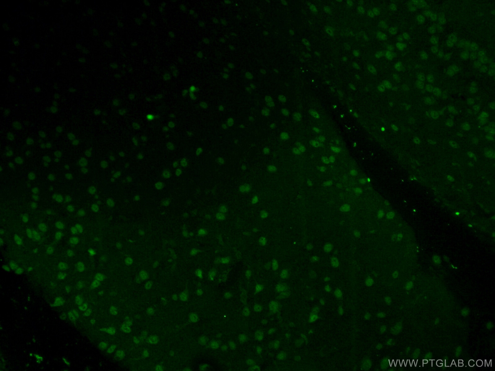 IF Staining of mouse brain using 15645-1-AP