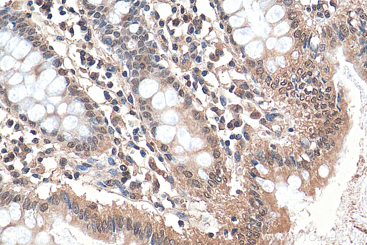 Immunohistochemistry (IHC) staining of human colon tissue using POM121 Polyclonal antibody (15645-1-AP)