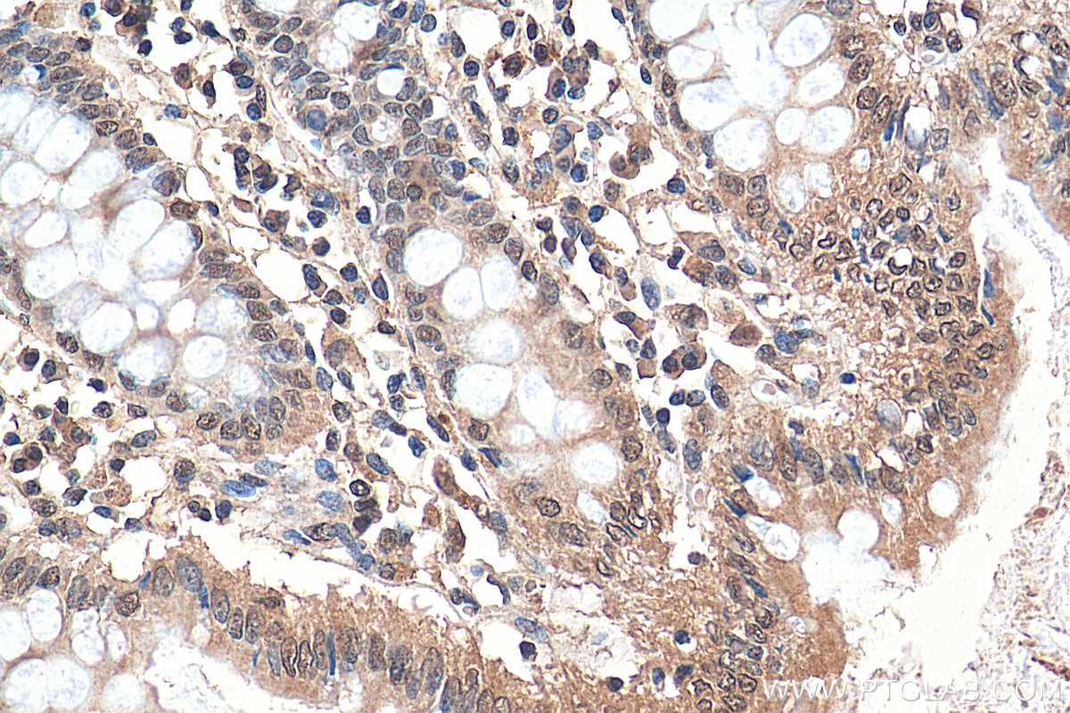 IHC staining of human colon using 15645-1-AP