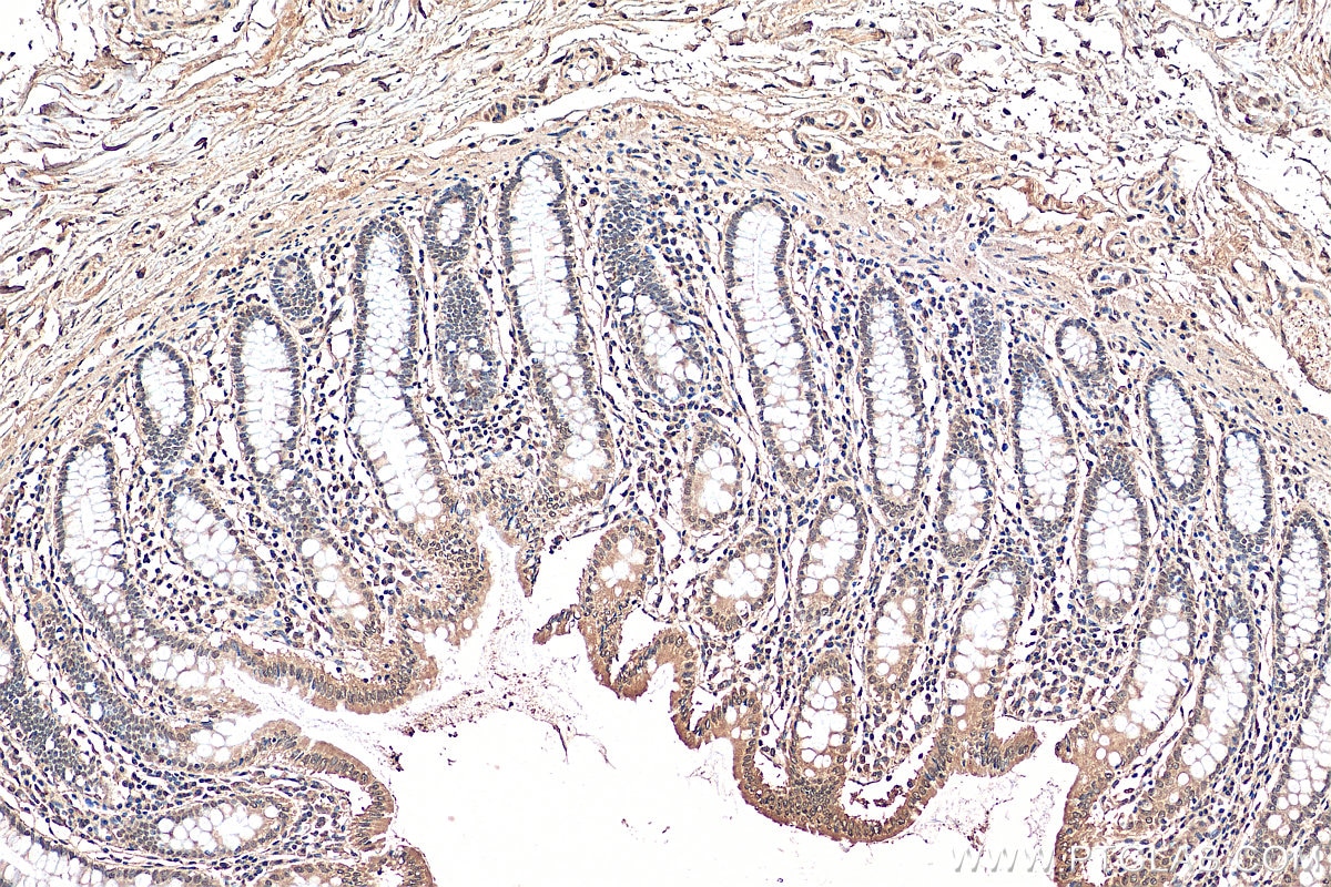Immunohistochemistry (IHC) staining of human colon tissue using POM121 Polyclonal antibody (15645-1-AP)