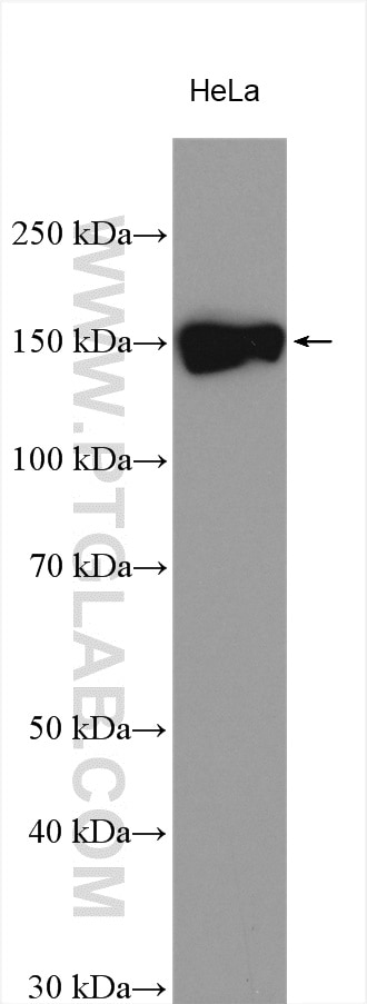 Western Blot (WB) analysis of various lysates using POM121 Polyclonal antibody (15645-1-AP)