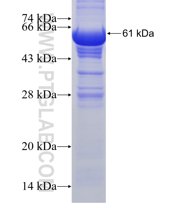 POM121 fusion protein Ag8177 SDS-PAGE