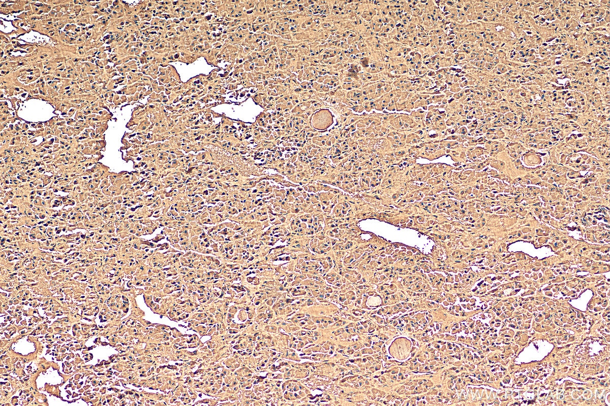 IHC staining of human pituitary using 22102-1-AP