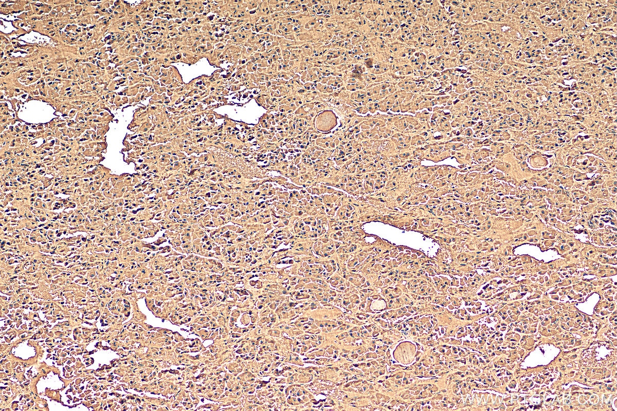 Immunohistochemistry (IHC) staining of human pituitary tissue using POMC Polyclonal antibody (22102-1-AP)