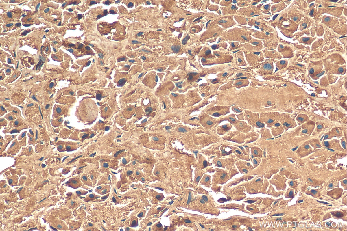 Immunohistochemistry (IHC) staining of human pituitary tissue using POMC Polyclonal antibody (22102-1-AP)