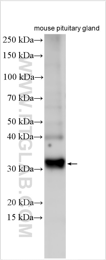 Western Blot (WB) analysis of various lysates using POMC Polyclonal antibody (22102-1-AP)