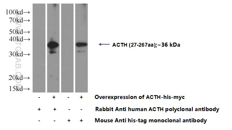 Western Blot (WB) analysis of Transfected HEK-293 cells using POMC Polyclonal antibody (22102-1-AP)