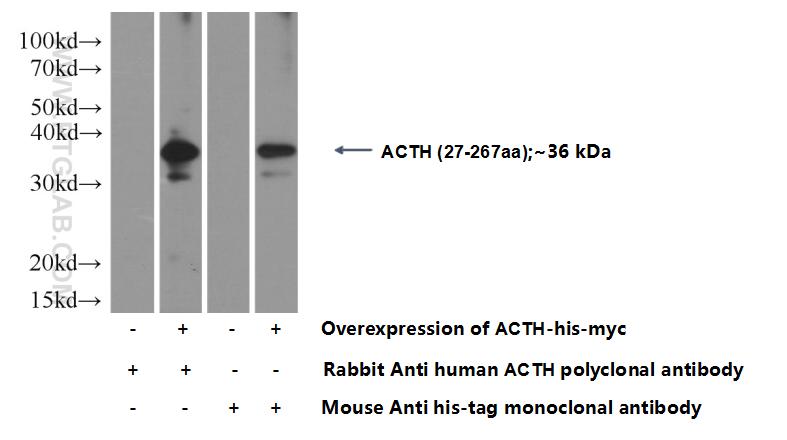 WB analysis of Transfected HEK-293 using 22102-1-AP