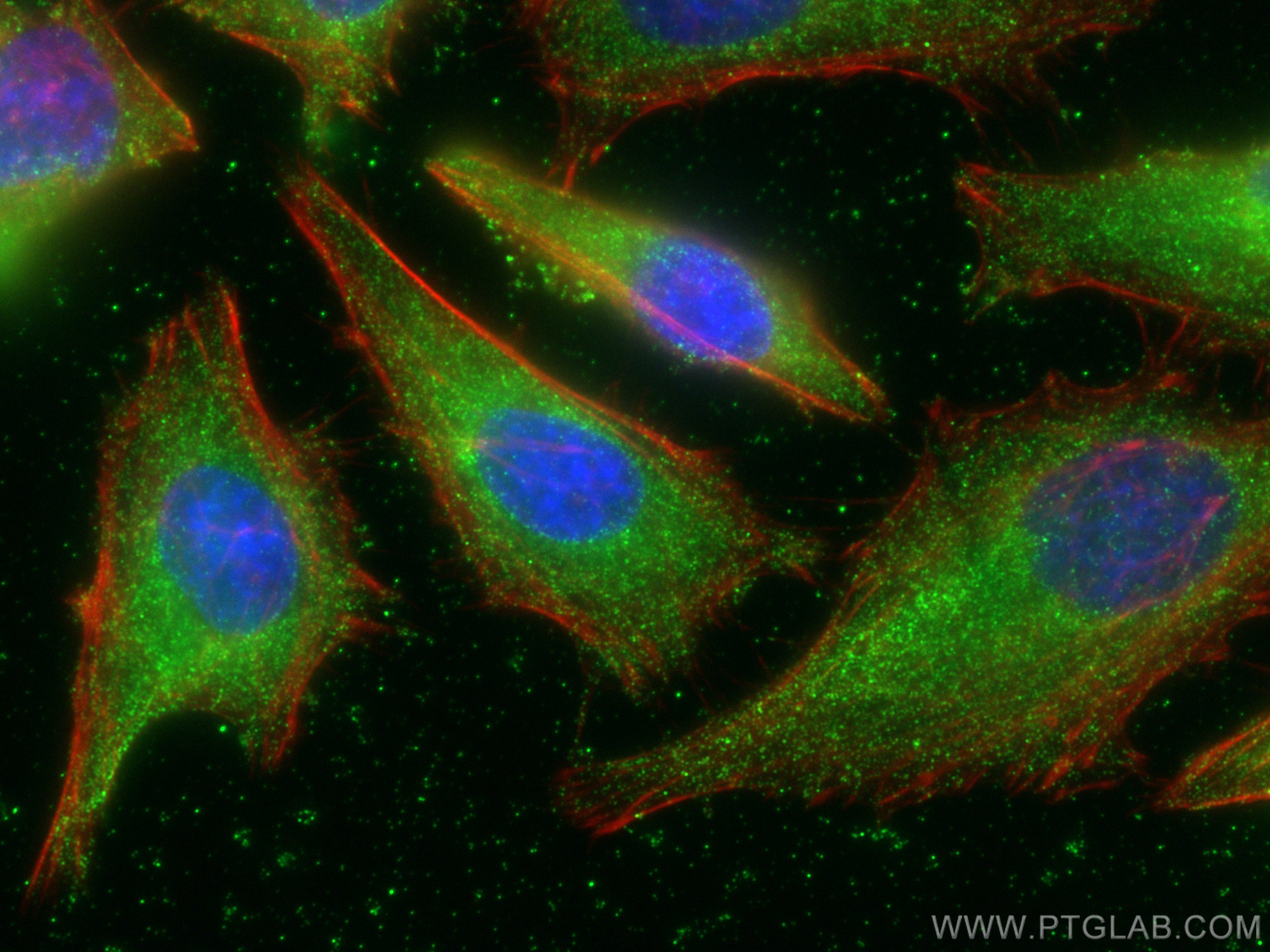 Immunofluorescence (IF) / fluorescent staining of HeLa cells using POMC Monoclonal antibody (66358-1-Ig)