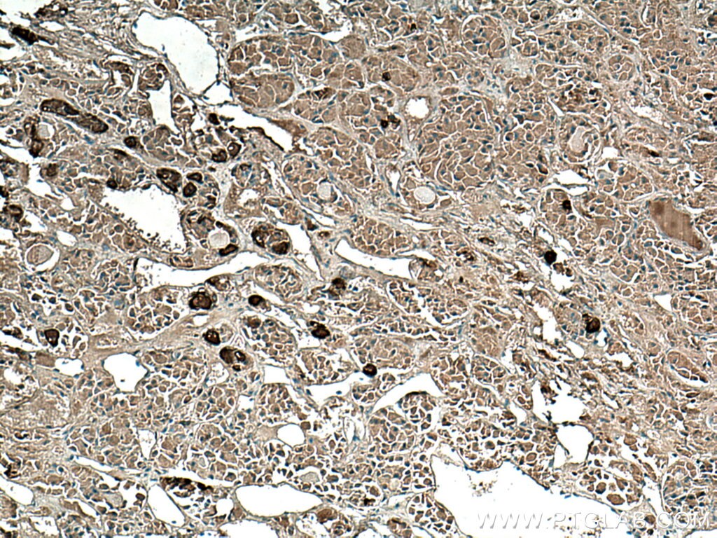 Immunohistochemistry (IHC) staining of human pituitary tissue using POMC Monoclonal antibody (66358-1-Ig)