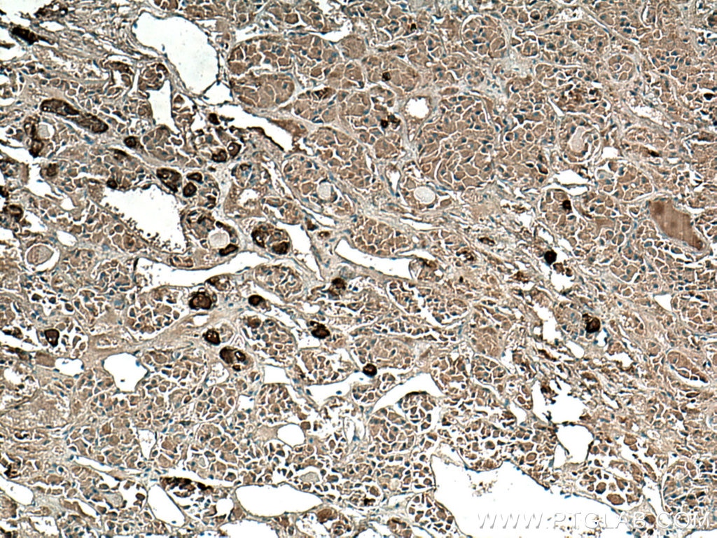 IHC staining of human pituitary using 66358-1-Ig