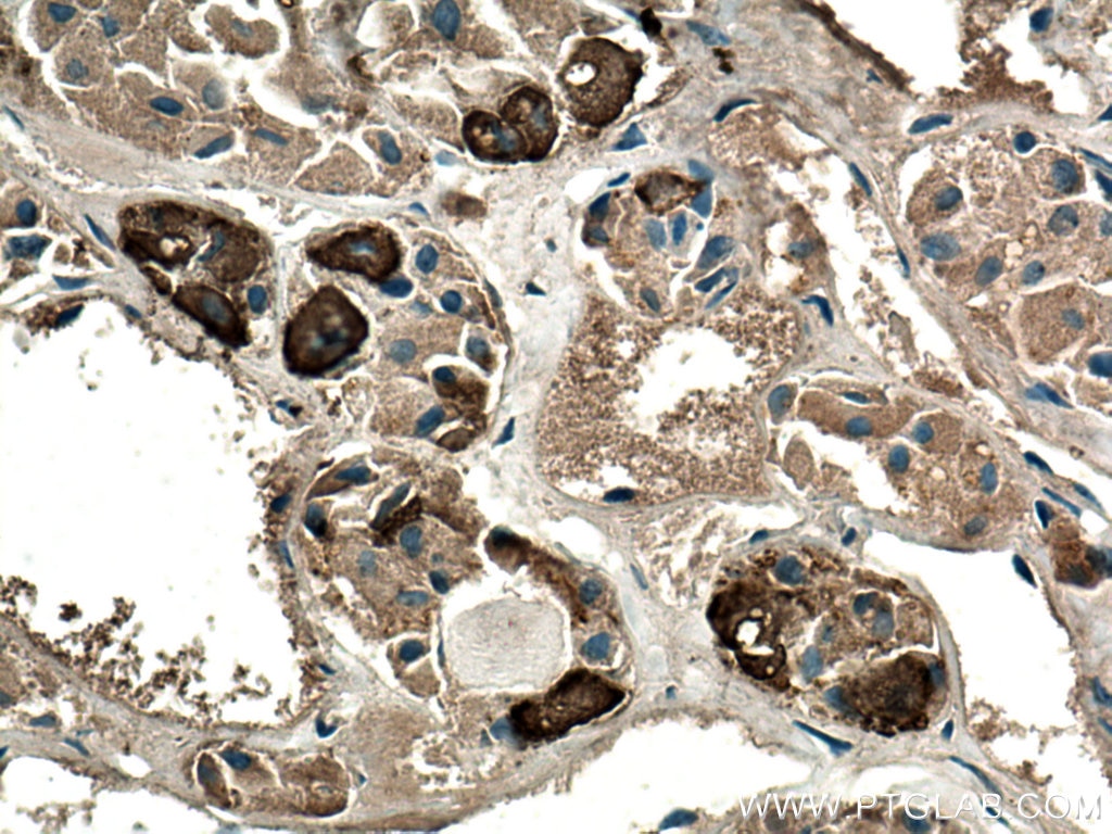 Immunohistochemistry (IHC) staining of human pituitary tissue using POMC Monoclonal antibody (66358-1-Ig)