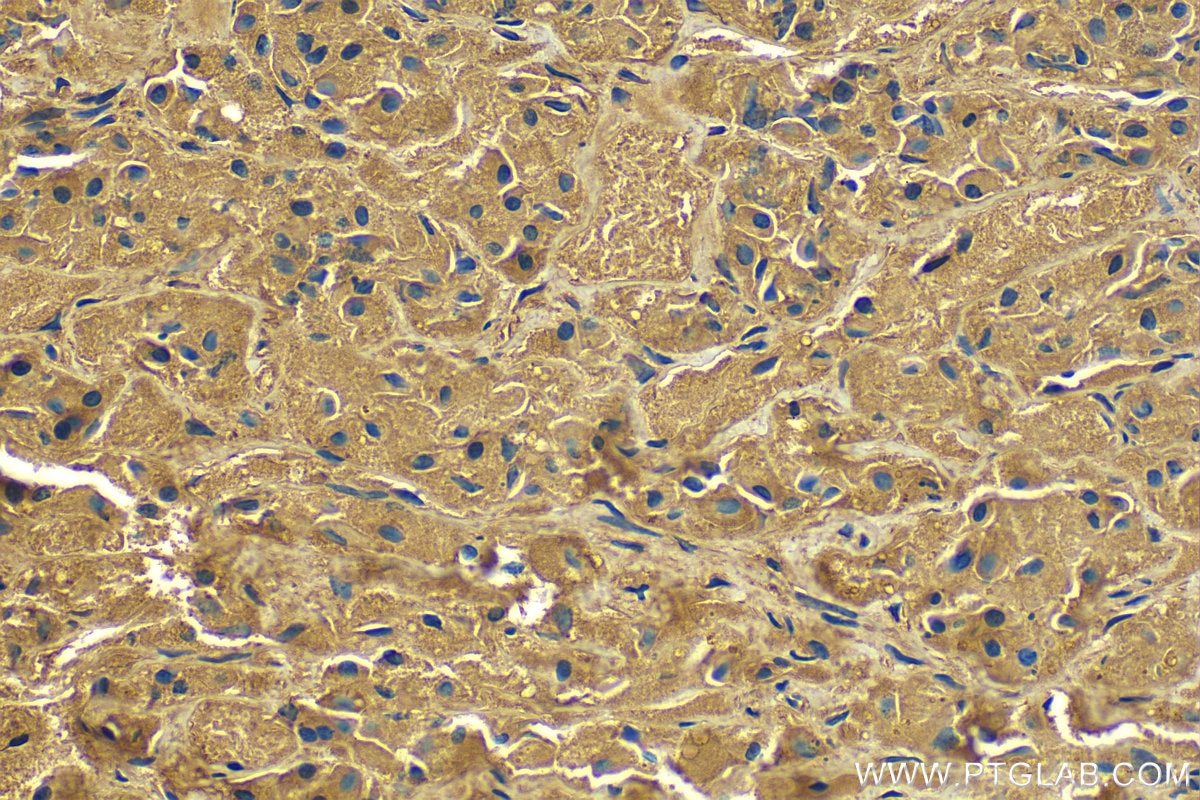 Immunohistochemistry (IHC) staining of human pituitary tissue using POMC Monoclonal antibody (66358-1-Ig)