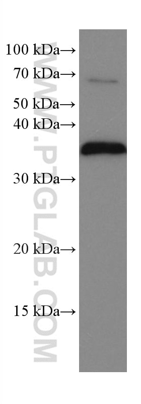 Western Blot (WB) analysis of A375 cells using POMC Monoclonal antibody (66358-1-Ig)