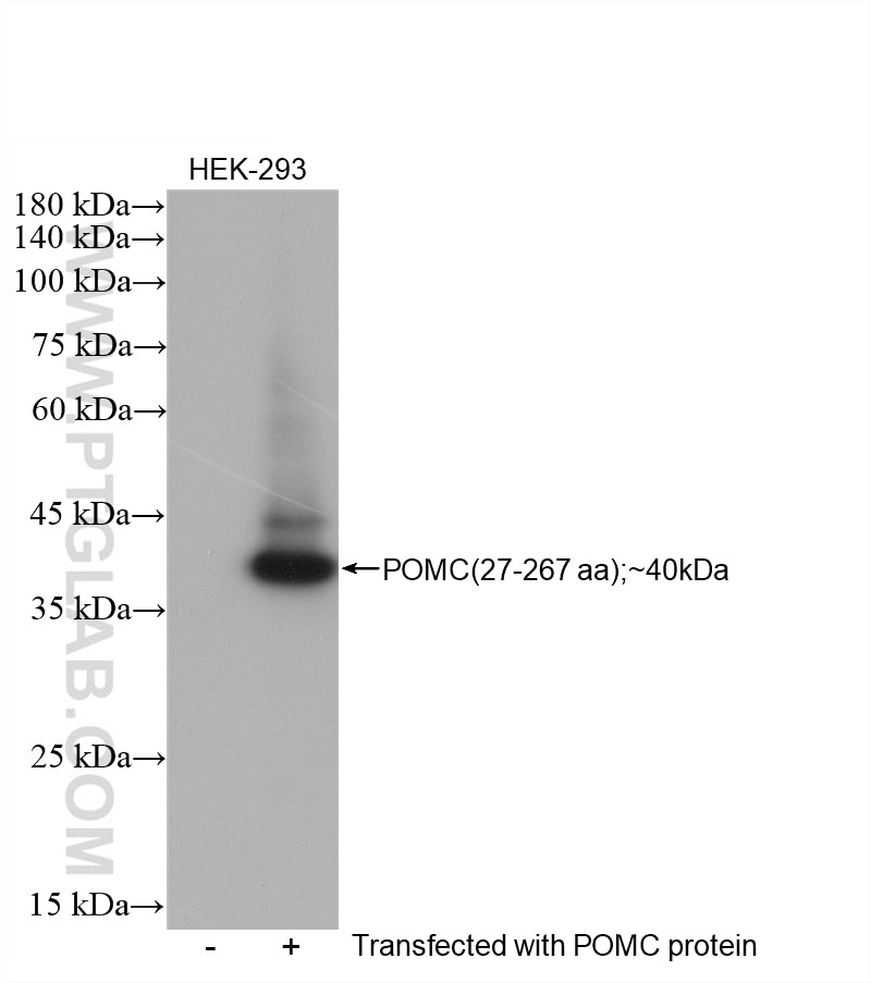 Western Blot (WB) analysis of Transfected HEK-293 cells using POMC Monoclonal antibody (66358-1-Ig)