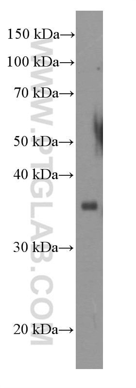 Western Blot (WB) analysis of rat brain tissue using POMC Monoclonal antibody (66358-1-Ig)