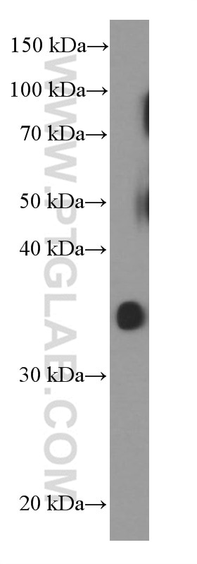 Western Blot (WB) analysis of A375 cells using POMC Monoclonal antibody (66358-1-Ig)