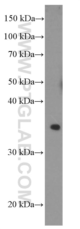 Western Blot (WB) analysis of human placenta tissue using POMC Monoclonal antibody (66358-1-Ig)