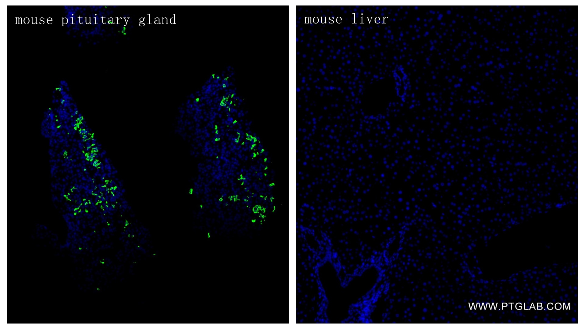 IF Staining of mouse pituitary gland using 82498-2-RR Immunofluorescence (IF) / fluorescent staining of mouse pituitary gland tissue using POMC Recombinant monoclonal antibody (82498-2-RR)