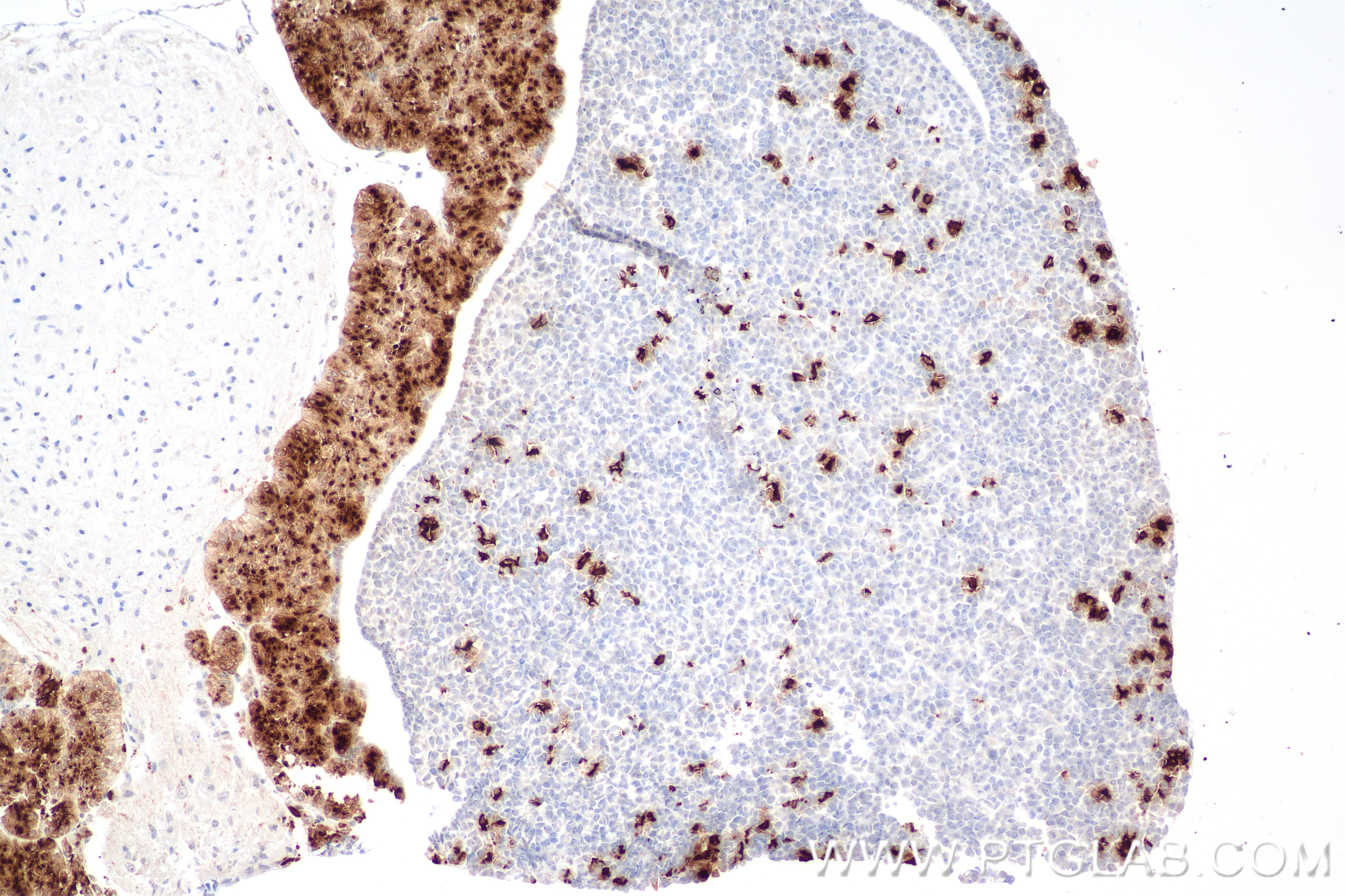 IHC staining of mouse pituitary gland using 82498-2-RR Immunohistochemistry (IHC) staining of mouse pituitary gland tissue using POMC Recombinant monoclonal antibody (82498-2-RR)