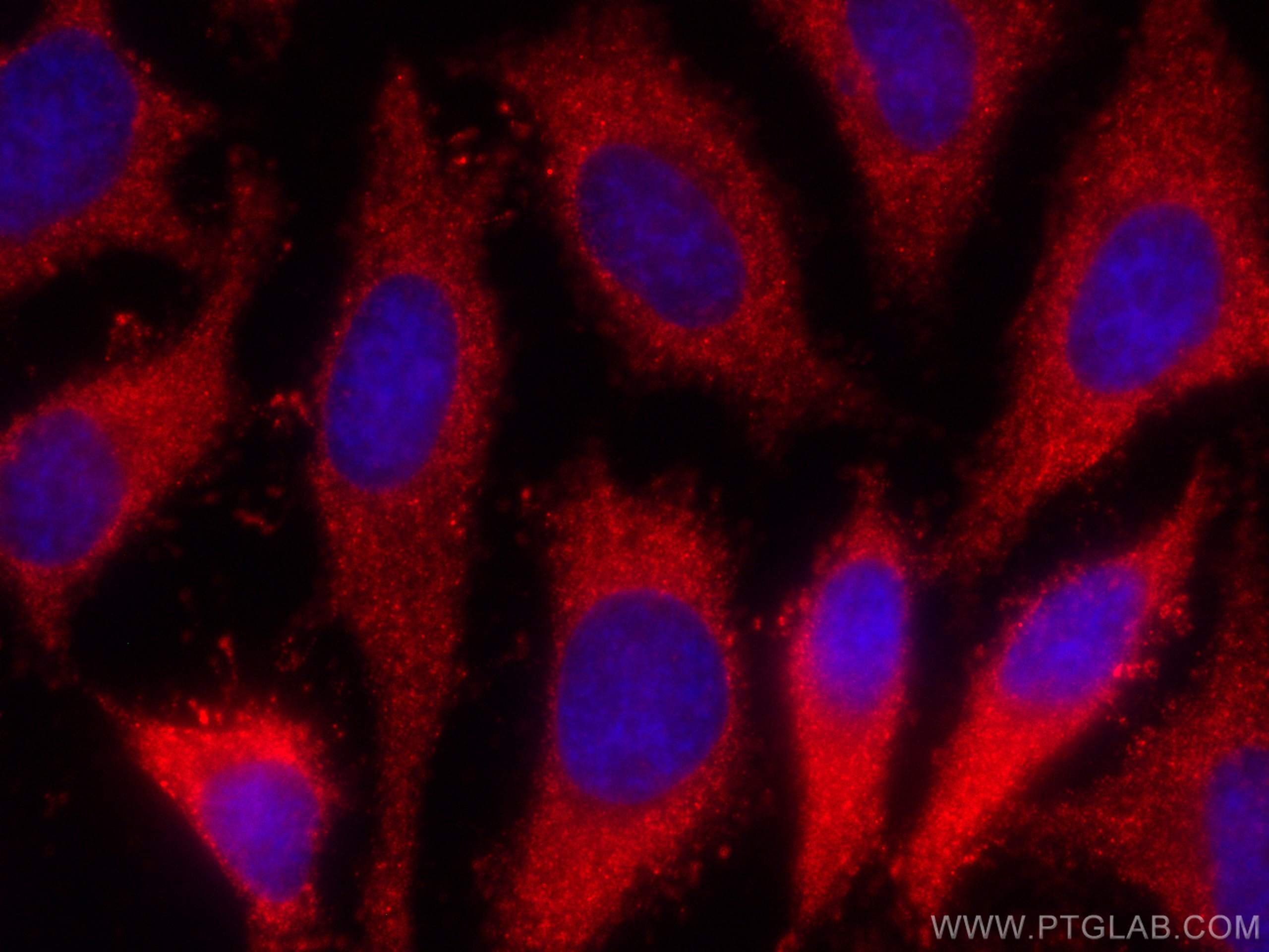 Immunofluorescence (IF) / fluorescent staining of HeLa cells using CoraLite®594-conjugated POMC Monoclonal antibody (CL594-66358)
