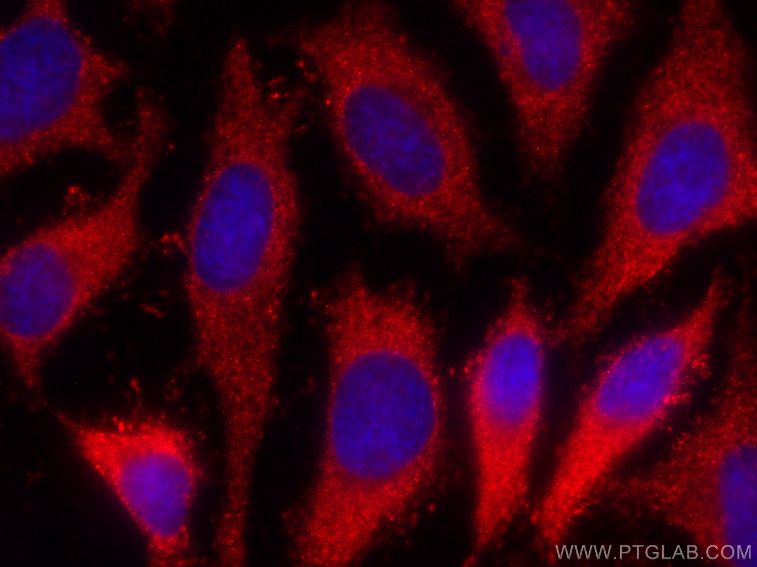 IF Staining of HeLa using CL594-66358