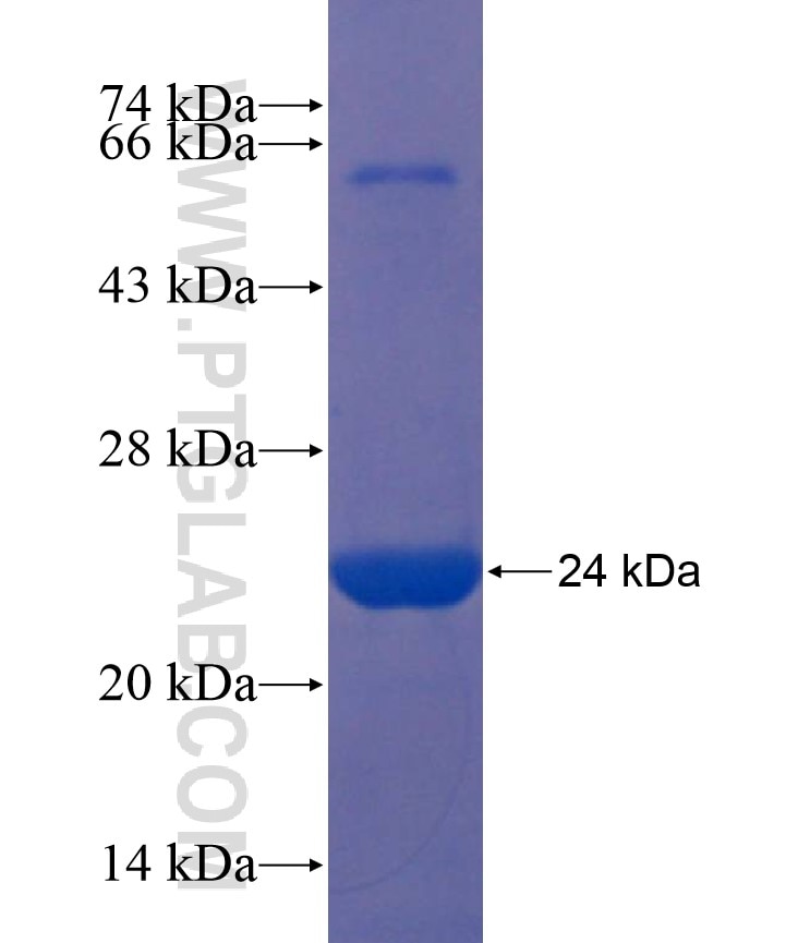 POMC fusion protein Ag17645 SDS-PAGE